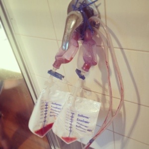 The Exudrain twins have been separated.