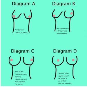 Unfortunately, despite being two and a half years past diagnosis, I am still stuck at Diagram B. 